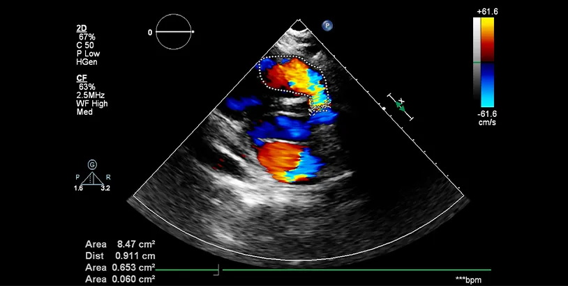 Colour Doppler Imaging equipment at Sun Imaging & Diagnostics